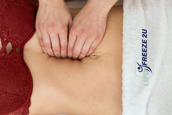 diastasis recti treatment Altrincham