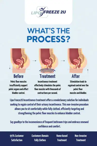 Diagram of how incontinence treatment Altrincham works.