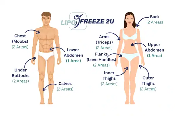 Areas you can have fat freezing treatment Altrincham