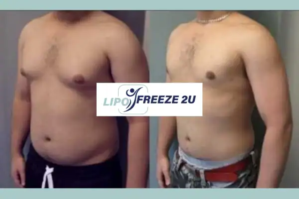 How Long Does It Take to See Results Altrincham?