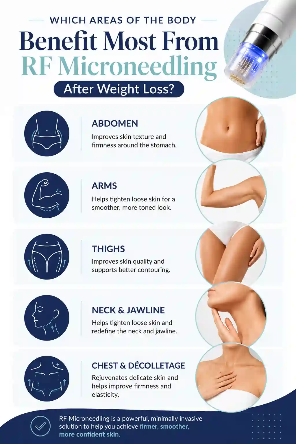 Which Areas of the Body Benefit Most From RF Microneedling After Weight Loss Altrincham